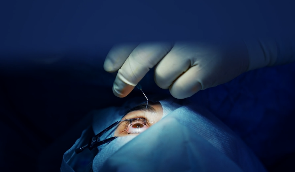 LASIK Laser Eye Surgery